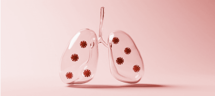 Pulmonary Precision: Karius Launches Metagenomic Test for Lung Infections Pulmonary Precision: Karius Launches Metagenomic Test for Lung Infections