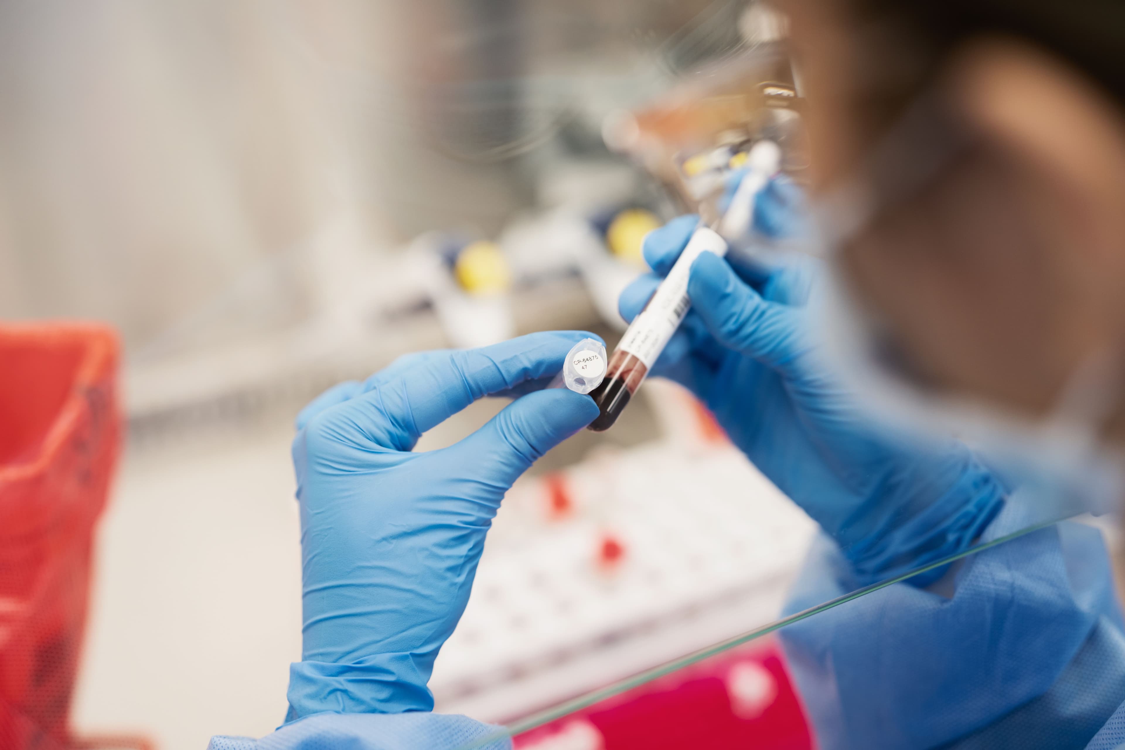 Real-world evidence study of 15,000 patients showing rapid 26-hour turnaround for plasma metagenomic sequencing with broad pathogen detection